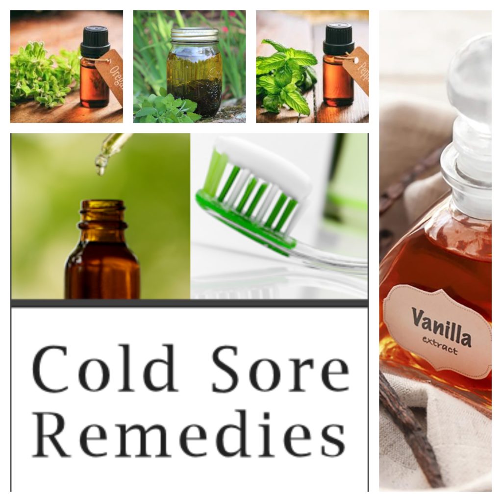 Best Home Remedy for Burns: Real Vanilla Extract (Why and How to