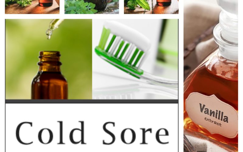 What Is the Best Treatment for Cold Sores? Holistic Ways of Treating Cold Sores